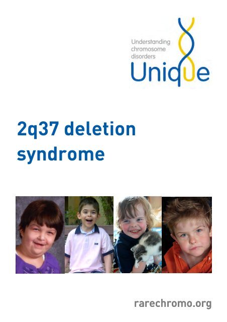 2q37 Deletion Syndrome Ftnw Unique The Rare Chromosome