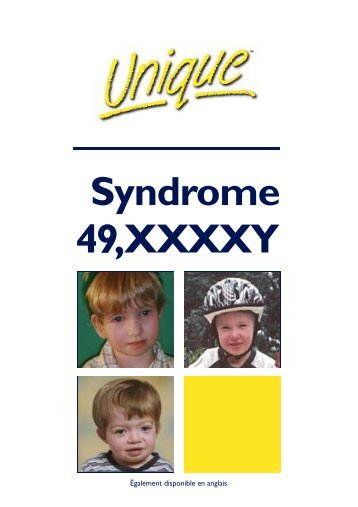 Syndrome 49,XXXXY - Unique - The Rare Chromosome Disorder ...