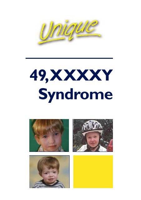 xxxxy syndrome