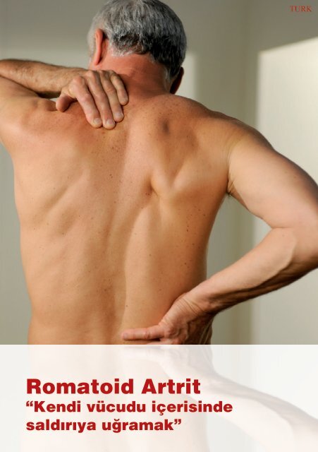Romatoid Artrit - Ratiopharm