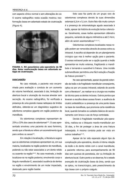 Odontoma complexo gigante em corpo de mandíbula - Revista de ...