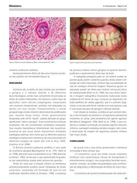 Ã­ndice - Revista Sobrape