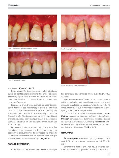 Ã­ndice - Revista Sobrape