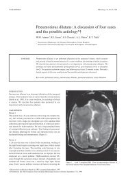 Pneumosinus dilatans - Rhinology Internation Journal