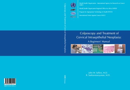 Colposcopy and Treatment of Cervical Intraepithelial Neoplasia - RHO