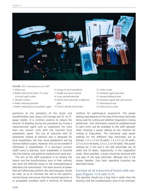 Colposcopy and Treatment of Cervical Intraepithelial Neoplasia - RHO