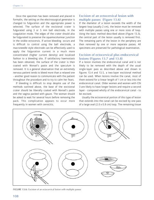 Colposcopy and Treatment of Cervical Intraepithelial Neoplasia - RHO