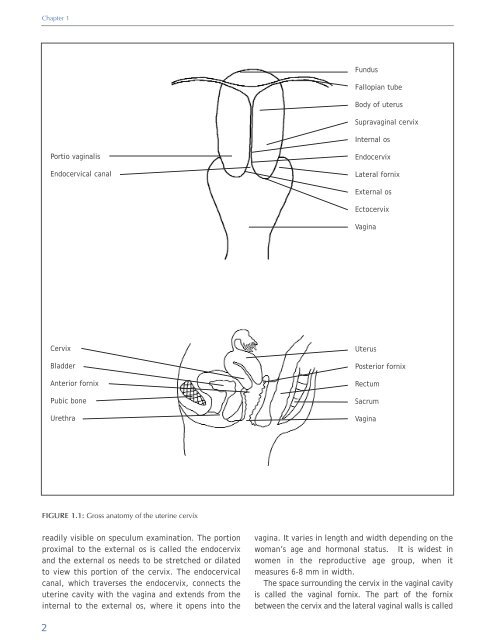 Colposcopy and Treatment of Cervical Intraepithelial Neoplasia - RHO