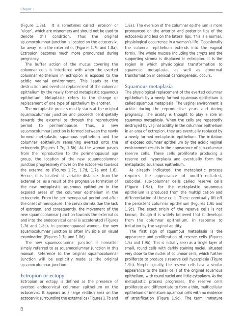 Colposcopy and Treatment of Cervical Intraepithelial Neoplasia - RHO