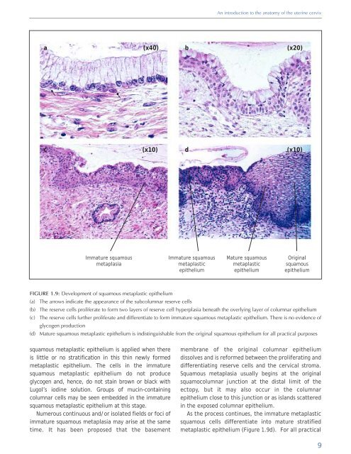 Colposcopy and Treatment of Cervical Intraepithelial Neoplasia - RHO