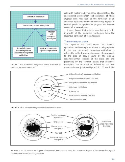 Colposcopy and Treatment of Cervical Intraepithelial Neoplasia - RHO