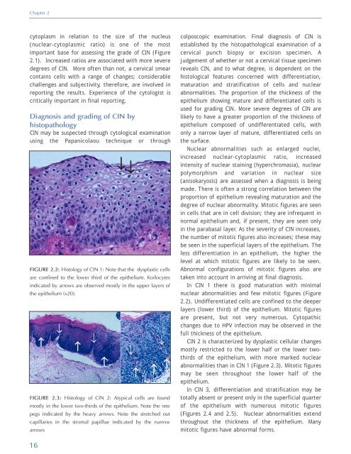 Colposcopy and Treatment of Cervical Intraepithelial Neoplasia - RHO