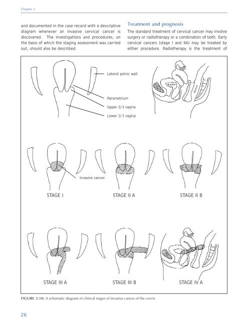 Colposcopy and Treatment of Cervical Intraepithelial Neoplasia - RHO