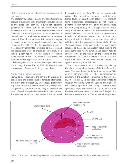 Colposcopy and Treatment of Cervical Intraepithelial Neoplasia - RHO