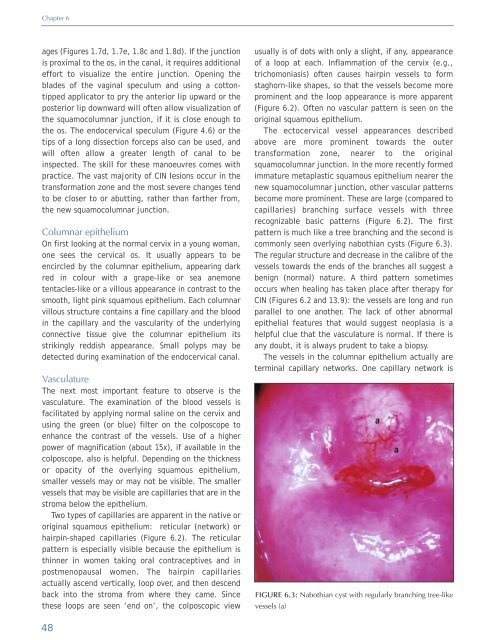 Colposcopy and Treatment of Cervical Intraepithelial Neoplasia - RHO