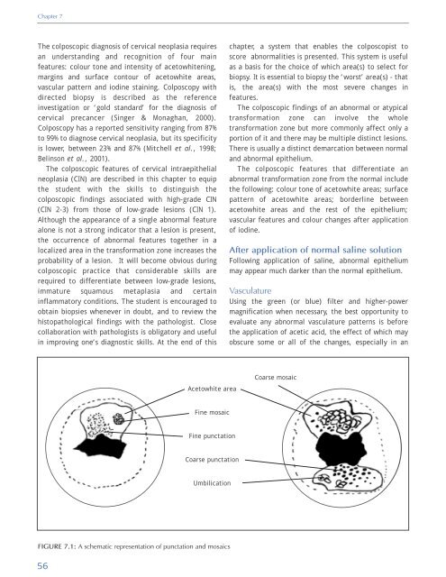 Colposcopy and Treatment of Cervical Intraepithelial Neoplasia - RHO