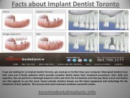 Facts about Implant Dentist Toronto