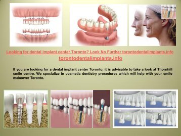 Looking for dental implant center Toronto? Look No Further torontodentalimplants.info