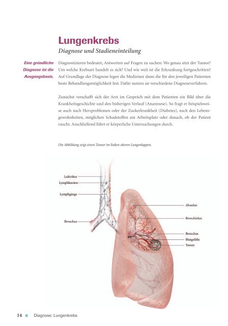 Leben mit Lungenkrebs - Roche in Deutschland