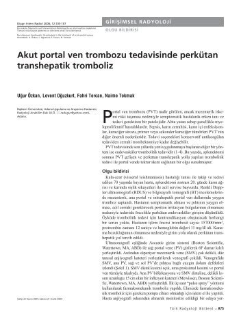 Akut portal ven trombozu tedavisinde perkÃ¼tan transhepatik tromboliz