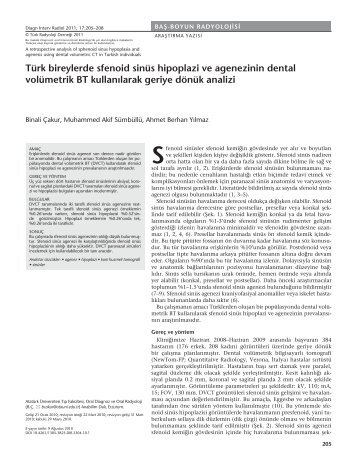 TÃ¼rk bireylerde sfenoid sinÃ¼s hipoplazi ve agenezinin dental ...