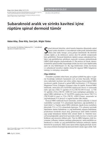 Subaraknoid aralÄ±k ve sirinks kavitesi iÃ§ine rÃ¼ptÃ¼re spinal dermoid ...