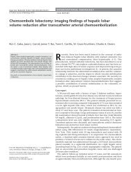 Chemoembolic lobectomy - Diagnostic and Interventional Radiology