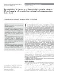 Demonstration of the course of the posterior intercostal artery on CT ...