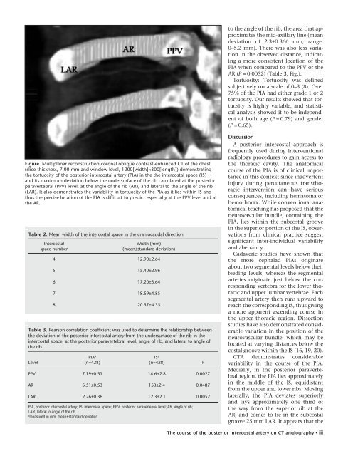 Demonstration of the course of the posterior intercostal artery on CT ...