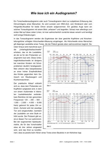 Wie lese ich ein Audiogramm? (Fred Warnke)