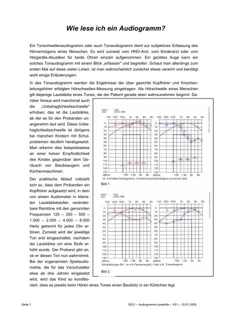 Wie lese ich ein Audiogramm? (Fred Warnke)