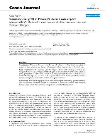 Corneoscleral graft in Mooren's ulcer: a case report