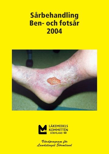 SÃ¥rbehandling Ben- och fotsÃ¥r 2004 - Landstinget SÃ¶rmland