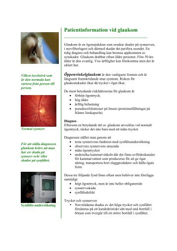 Patientinformation vid glaukom