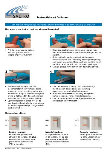 Instructiekaart D-dimeer - Saltro