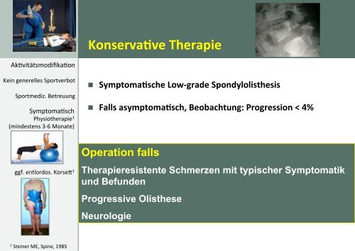 RÃ¼ckenschmerzen bei Spondylolisthesis ... - bei der SAMM