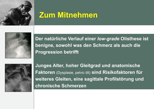 RÃ¼ckenschmerzen bei Spondylolisthesis ... - bei der SAMM