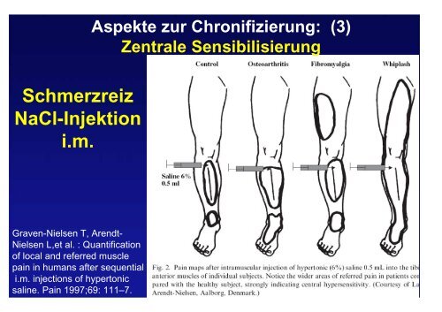 Management von Distorsionstraumen der HWS aus ... - bei der SAMM