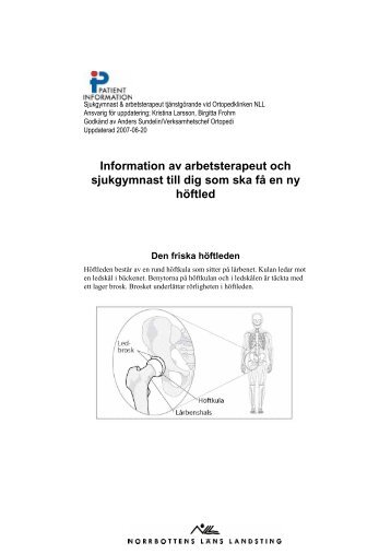 Information av arbetsterapeut och sjukgymnast till dig som ska fÃ¥ en ...