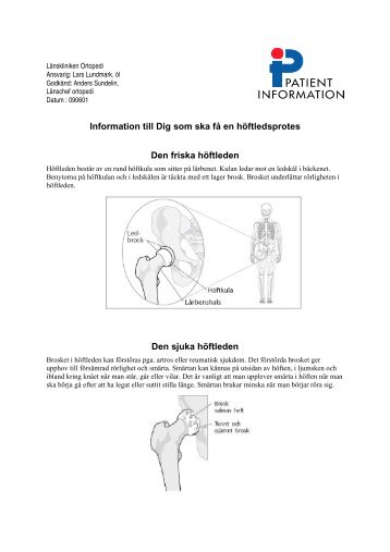 Information till Dig som ska fÃ¥ en hÃ¶ftledsprotes Den friska hÃ¶ftleden ...