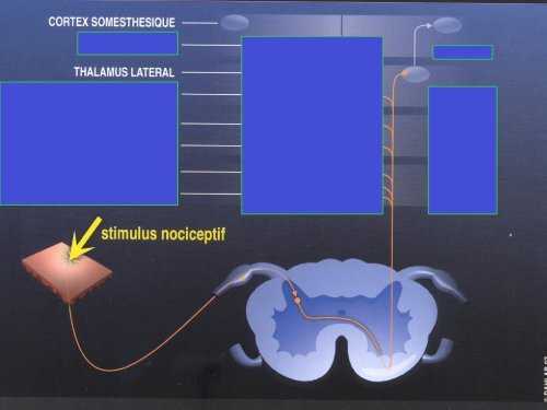 LES DOULEURS NEUROPATHIQUES