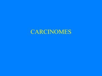 Carcinomes en Dermatologie