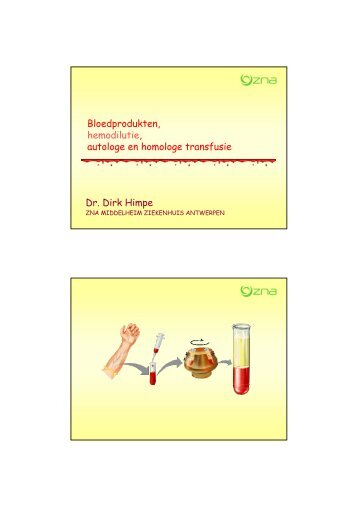 Bloedprodukten, hemodilutie, autologe en homologe transfusie
