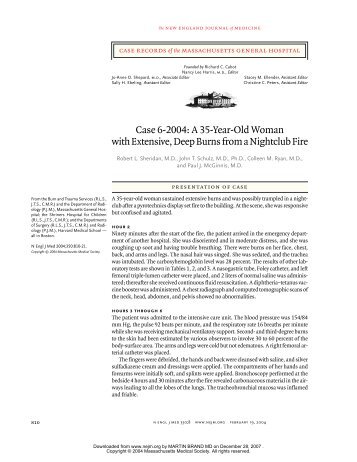 burn case study Case study: burns some background :) burns are injuries that cause damage to the skin and possible underlying layers of the skin depending on the depth and severity of them. burn case study Case study: burns some background :) burns are injuries that cause damage to the skin and possible underlying layers of the skin depending on the depth and severity of them.