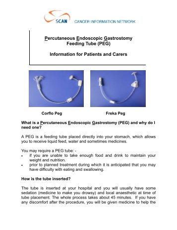 Percutaneous Endoscopic Gastrostomy Feeding Tube (PEG ... - SCAN