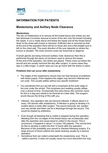 Mastectomy and axillary node clearance - SCAN