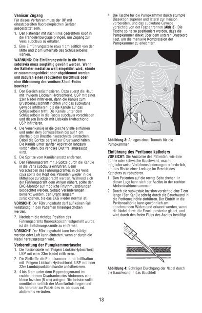 Denver Ascites Shunt PAK 42-2050/42-2055 - CareFusion