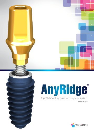 AnyRidge®