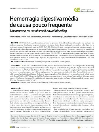 Hemorragia digestiva mÃ©dia de causa pouco frequente - SciELO