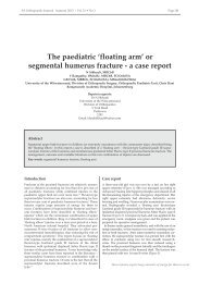 or segmental humerus fracture - a case report